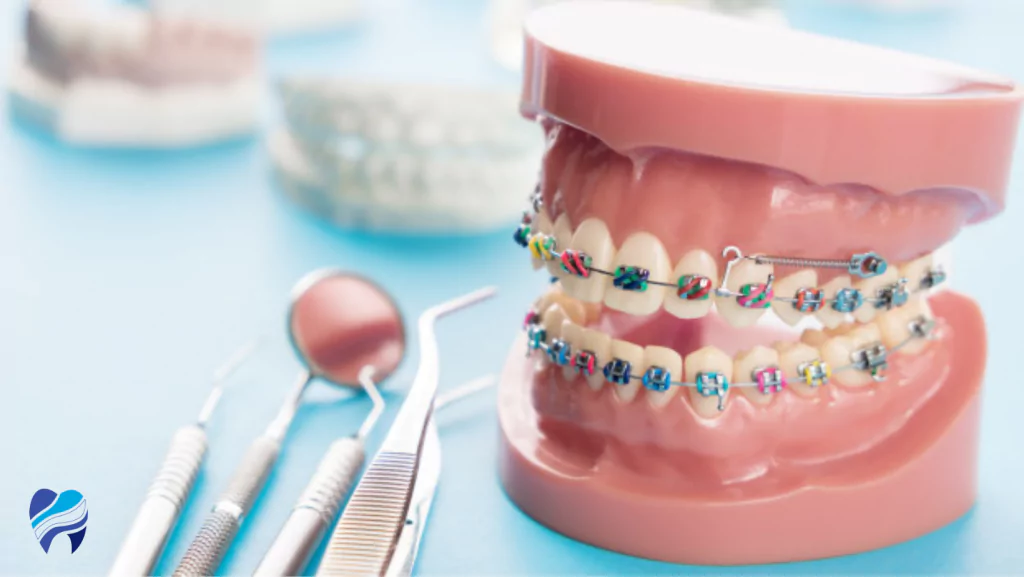 Top Orthodontist in Ventura