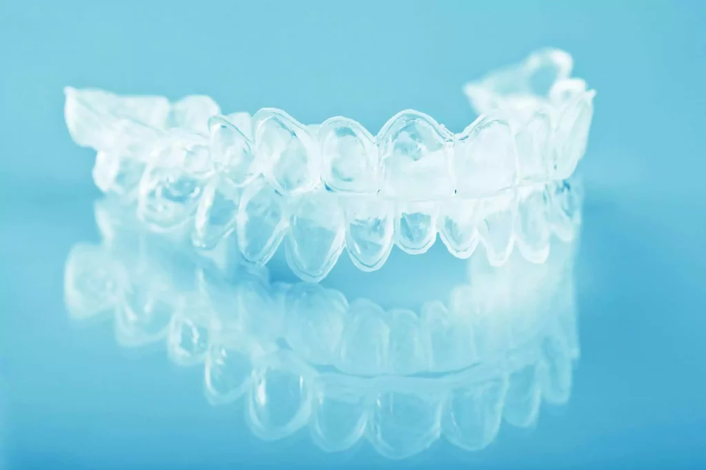 Invisalign Aligners