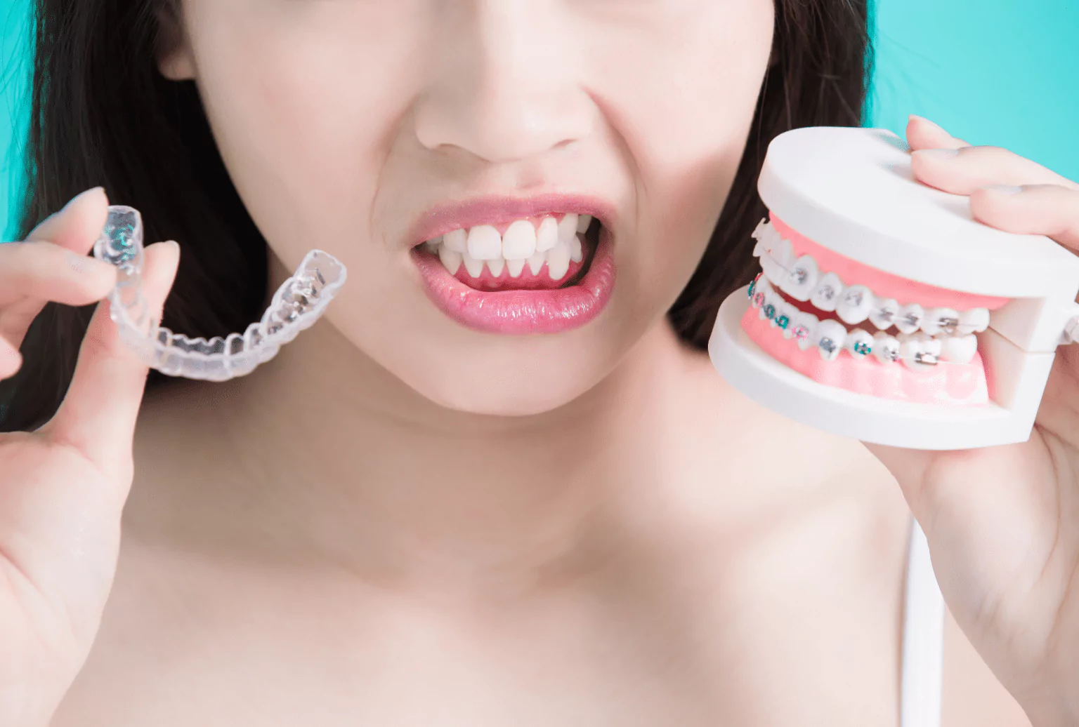 Invisalign Aligners in Ventura