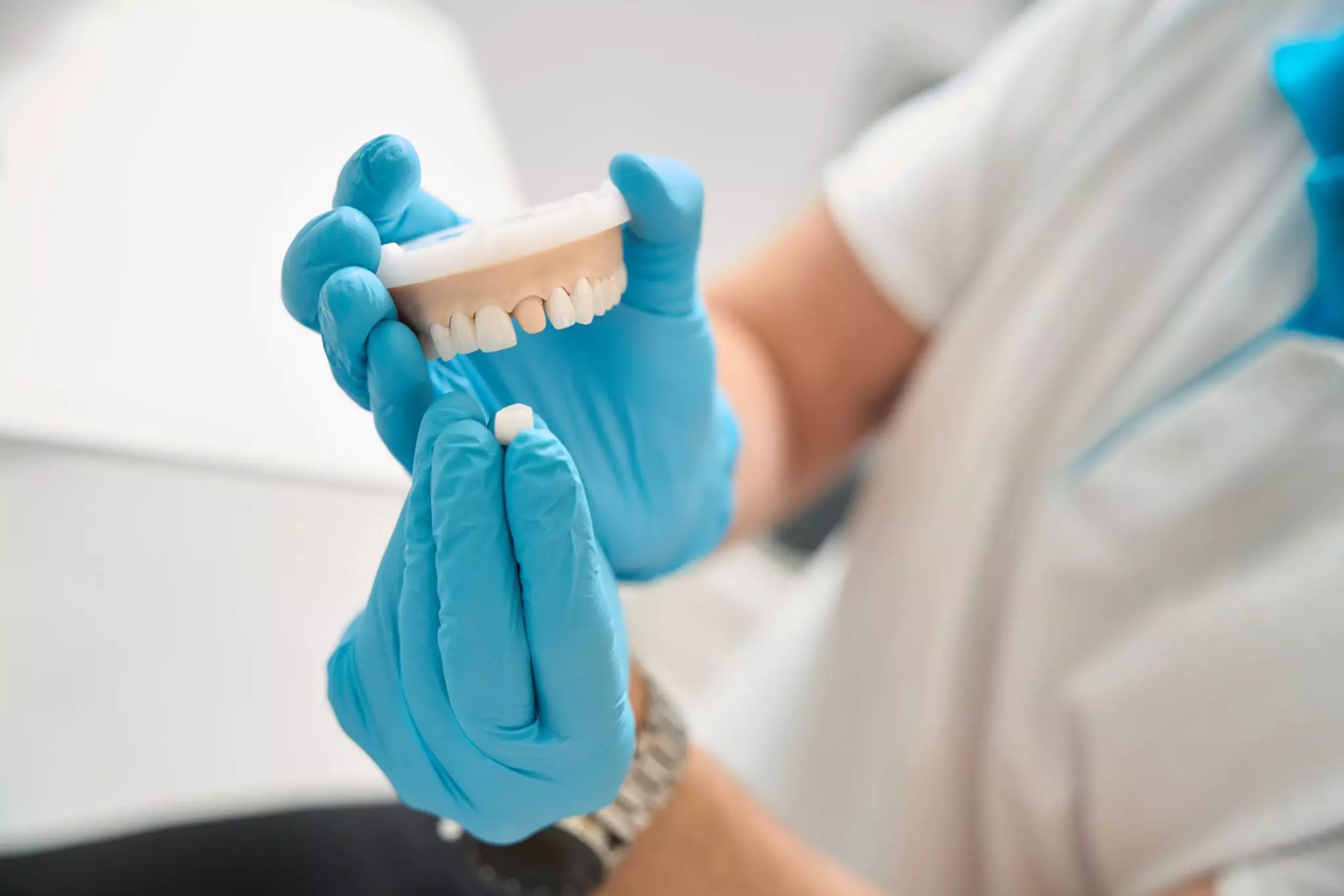 Dental Crowns In Ventura