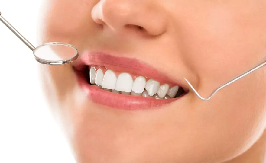 Teeth Whitening in Ventura