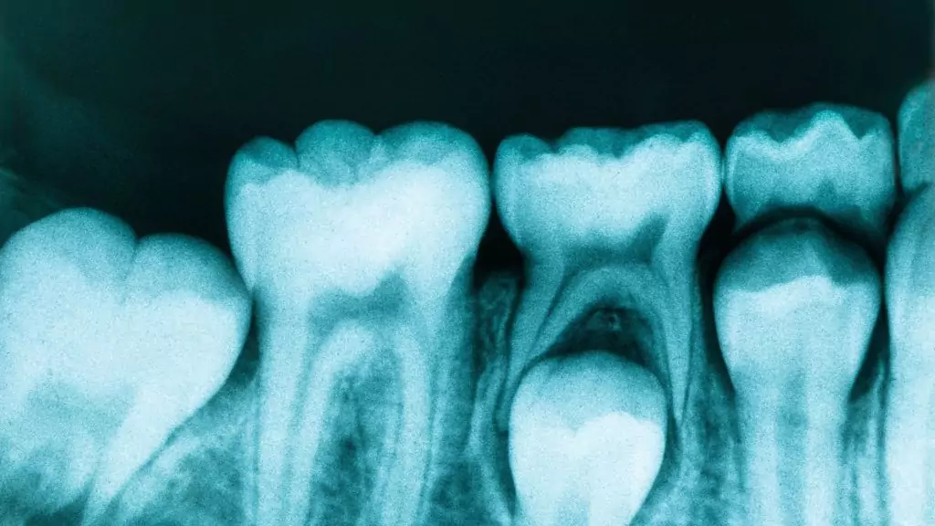 Intraoral Dental Imaging in Ventura