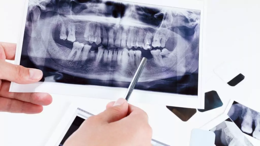 Intraoral Dental Imaging in Ventura