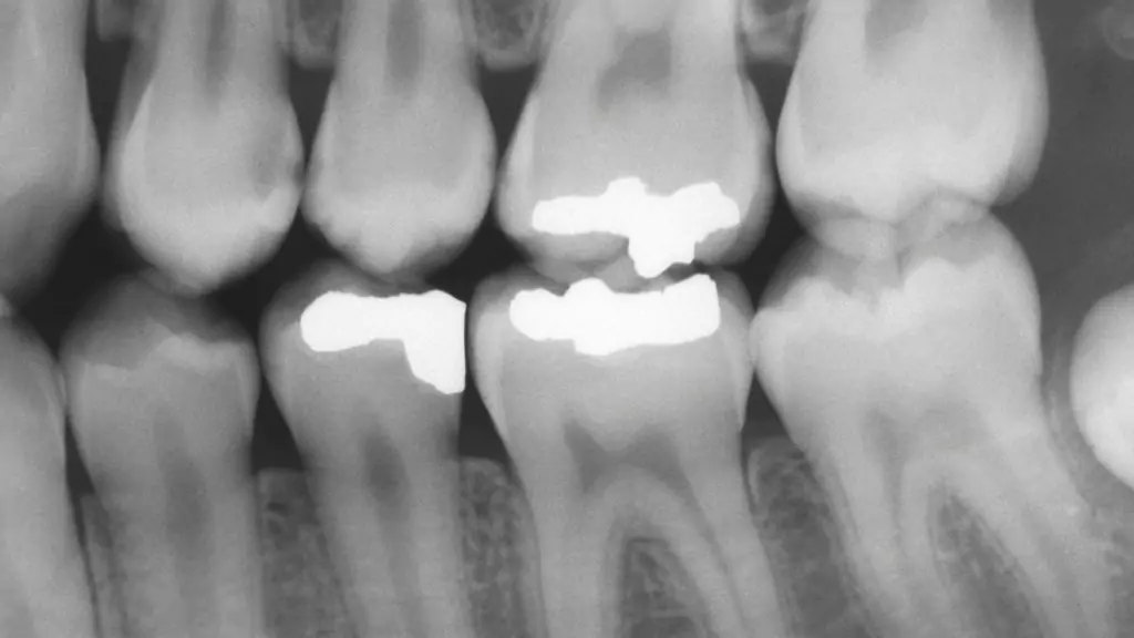 Intraoral Dental Imaging in Ventura