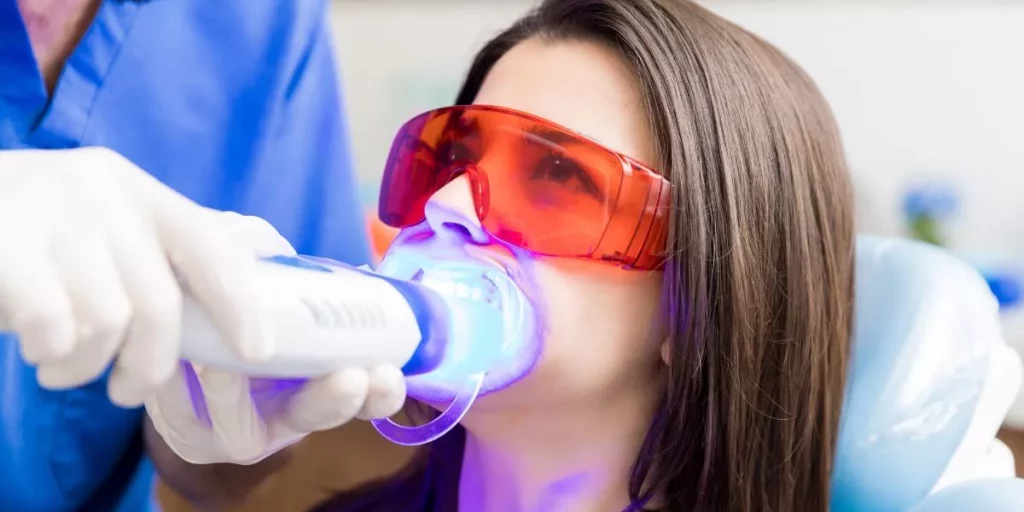 Blanqueamiento Dental Laser en Ventura | Zoom Profesional