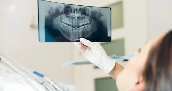 Dental implants The Dental Implant Process at Our Ventura Office