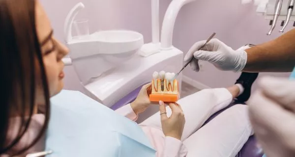 Dental implants What Are Dental Implants?