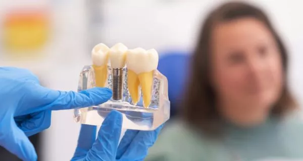 Extracciones Dentales, ventura Como puedes reemplazar un diente perdido?
