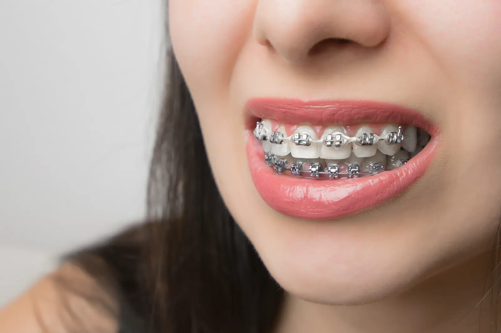 top orthodontist in ventura,orthodontics ventura,Orthodontic Treatment