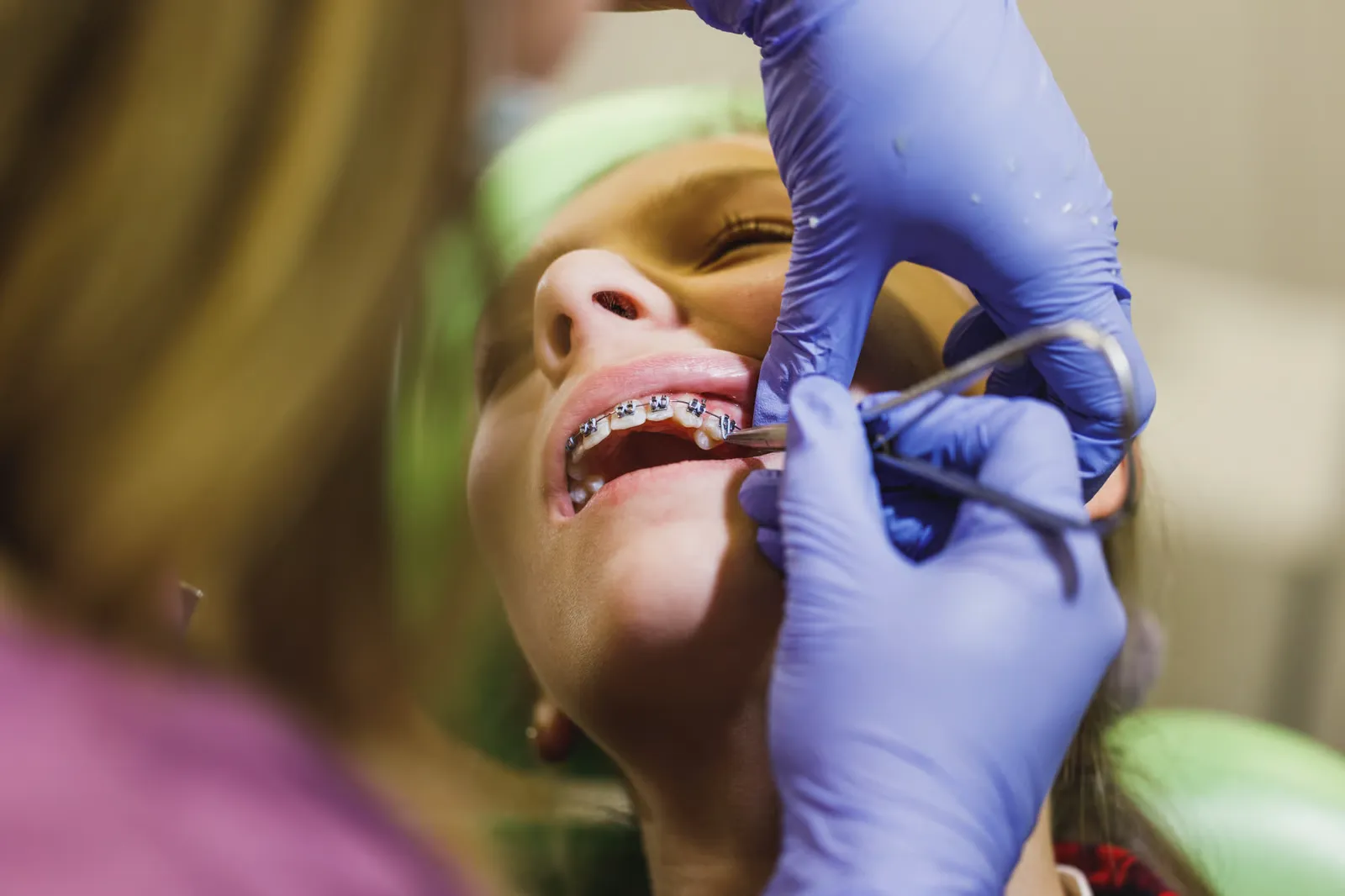 top orthodontist in ventura,orthodontics ventura,Orthodontic Treatment