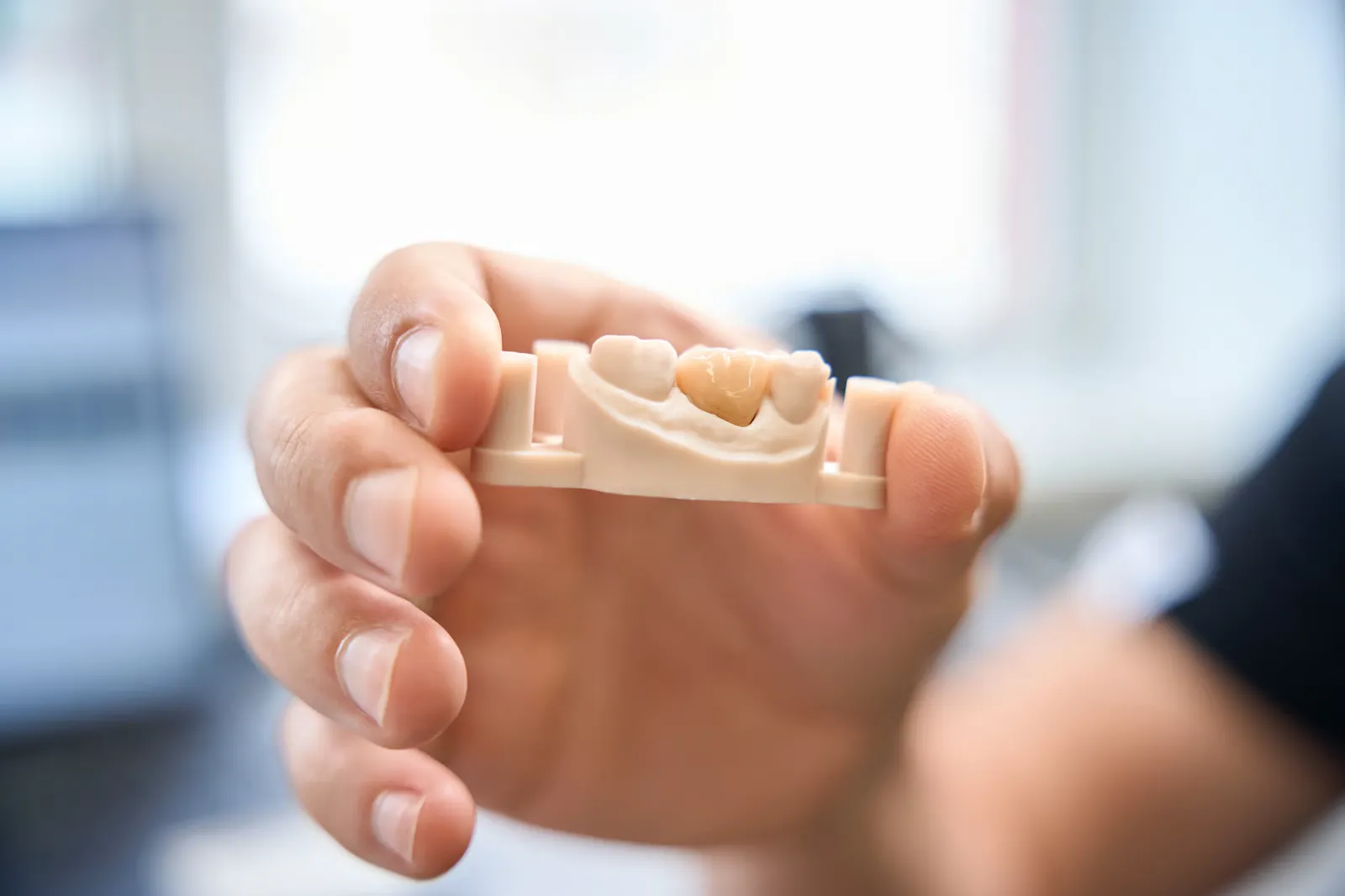 A model of a dental crown in a dentist's hand