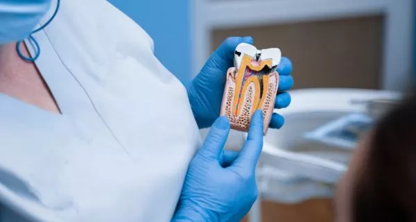 What is a root canal?