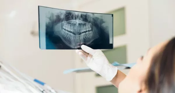 What to expect during your root canal visit