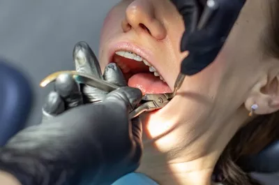 Servicios Dentales,ventura