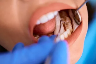 Servicios Dentales,ventura