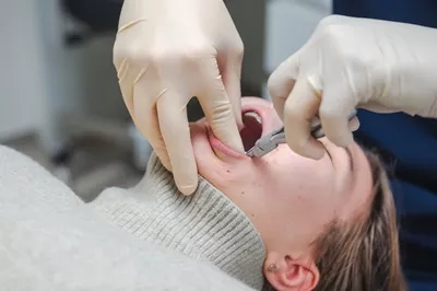 Servicios Dentales,ventura
