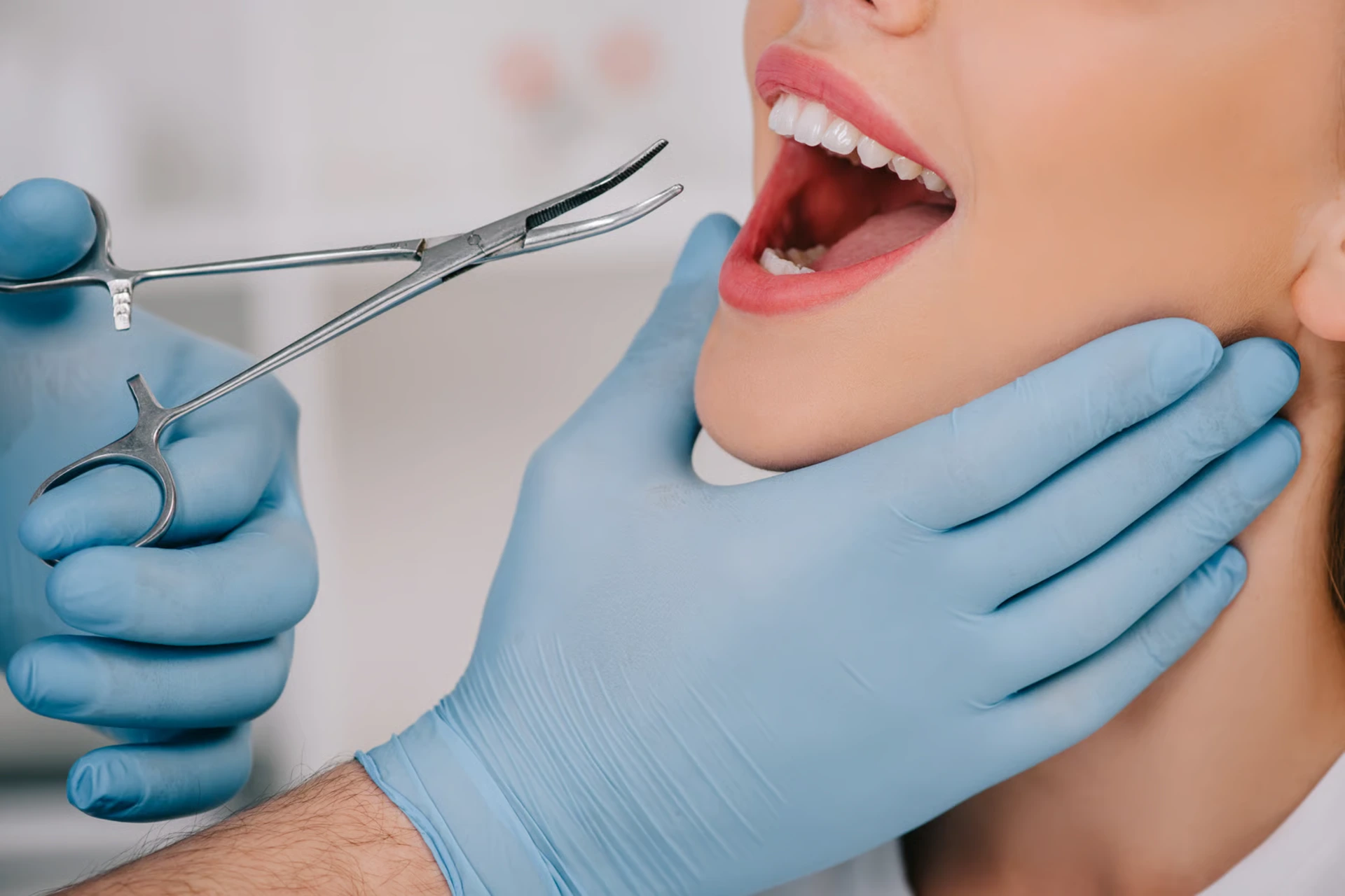 Dental Extraction in Ventura